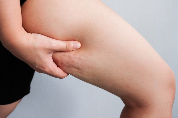 Dieta contro la cellulite: cosa mangiare?